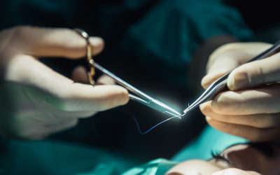 Lifting et blépharoplastie : est-ce utile de les associer ?