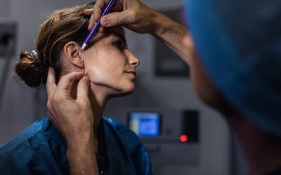 Mini-lift ou lifting complet : comment choisir la bonne indication ?