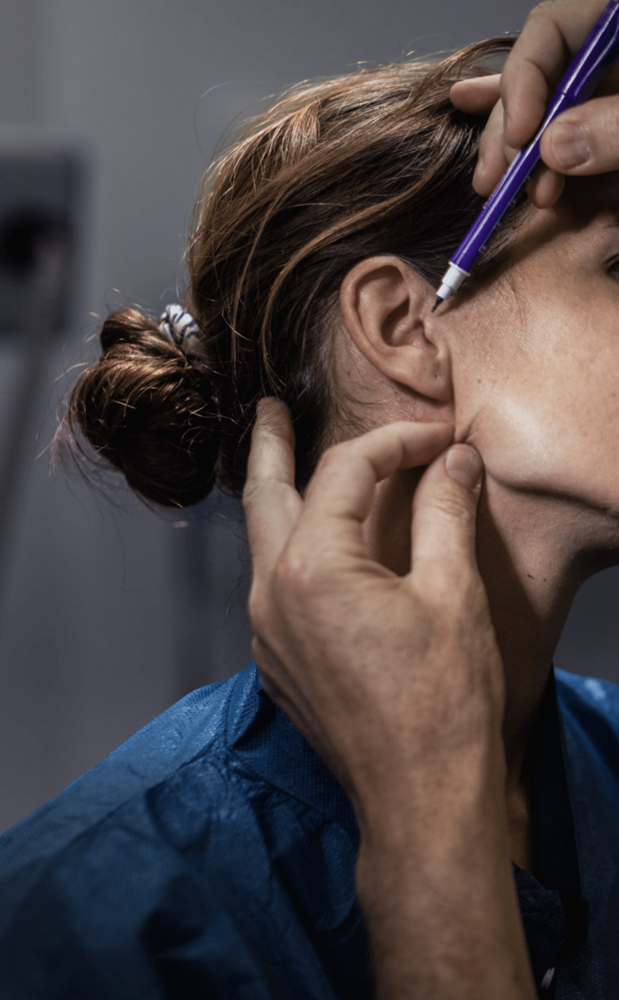 préparation avant un lifting du visage à Lyon